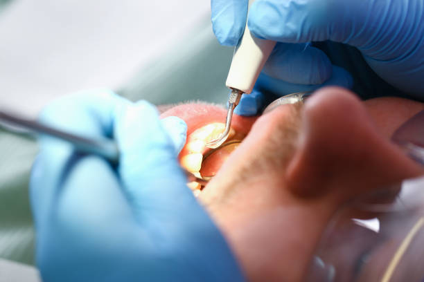 Best Cosmetic Emergency Dentistry in Parker, TX