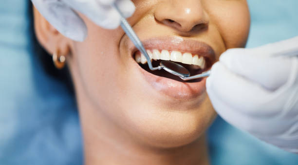 Best Emergency Treatment for Dental Infections or Abscesses in Parker, TX