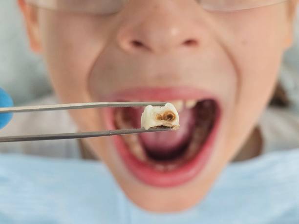 Best Same-Day Emergency Dental Services in Parker, TX